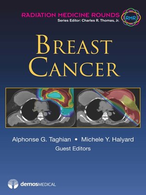 cover image of Breast Cancer